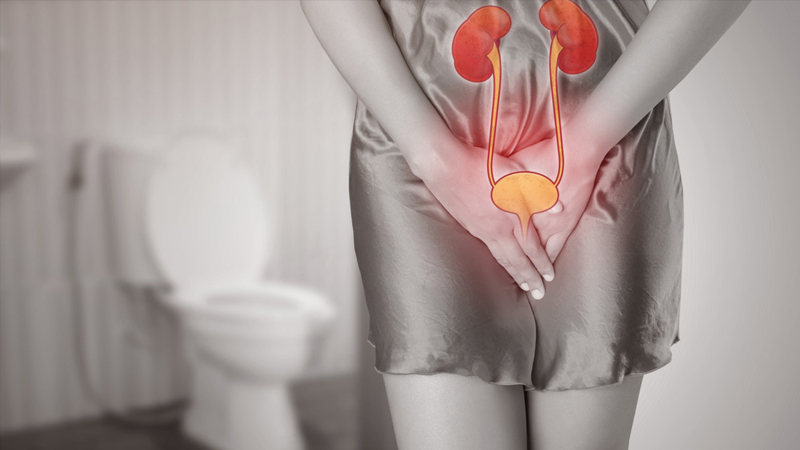 Tips Mencegah Penyakit Infeksi Saluran Kemih pada Wanita – PAFI Kab. Rokan Hilir